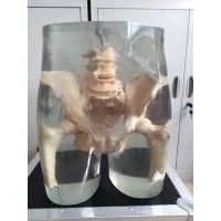 X射线髋关节模体-真人骨头X射线髋关节模体