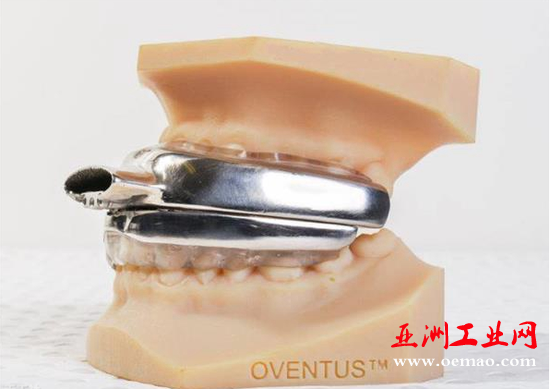 3D打印睡眠呼吸暂停治疗装置O2Ven将进入美国市场