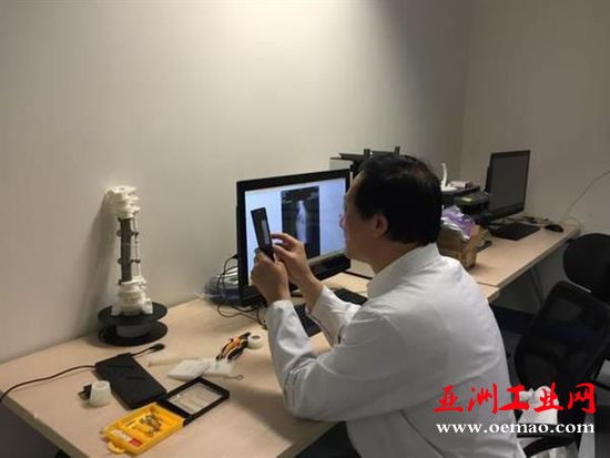 北医三院完成世界上首个3D打印脊椎手术