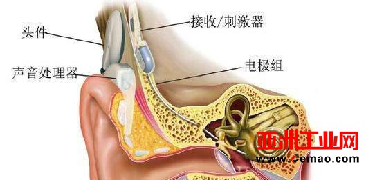 你敢让机器人给你做手术吗？