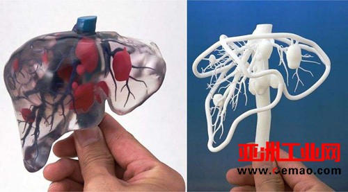 训练医生与服务患者 3D打印医疗模型双向发展
