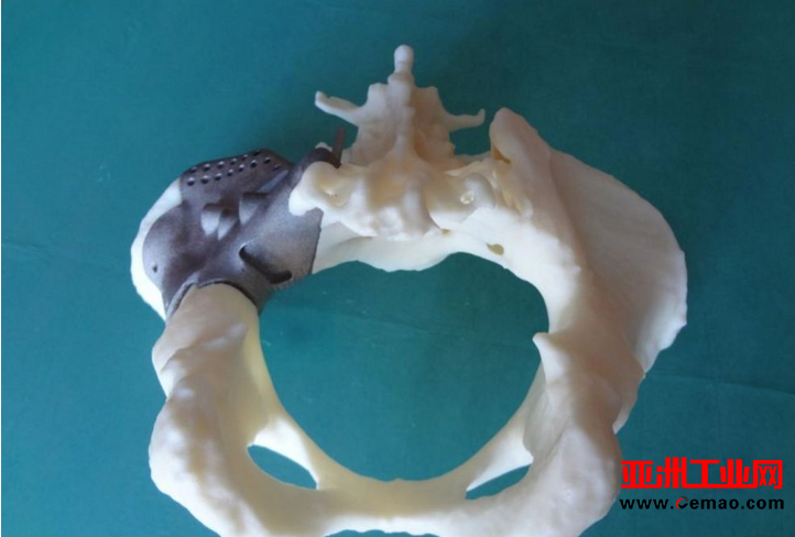 骨组织3D打印技术打印，成为骨再生的未来希望