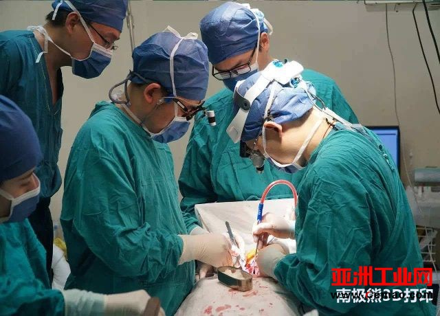 上海长征医院为患者植入15厘米长3D打印钛金属椎体，系全球首例